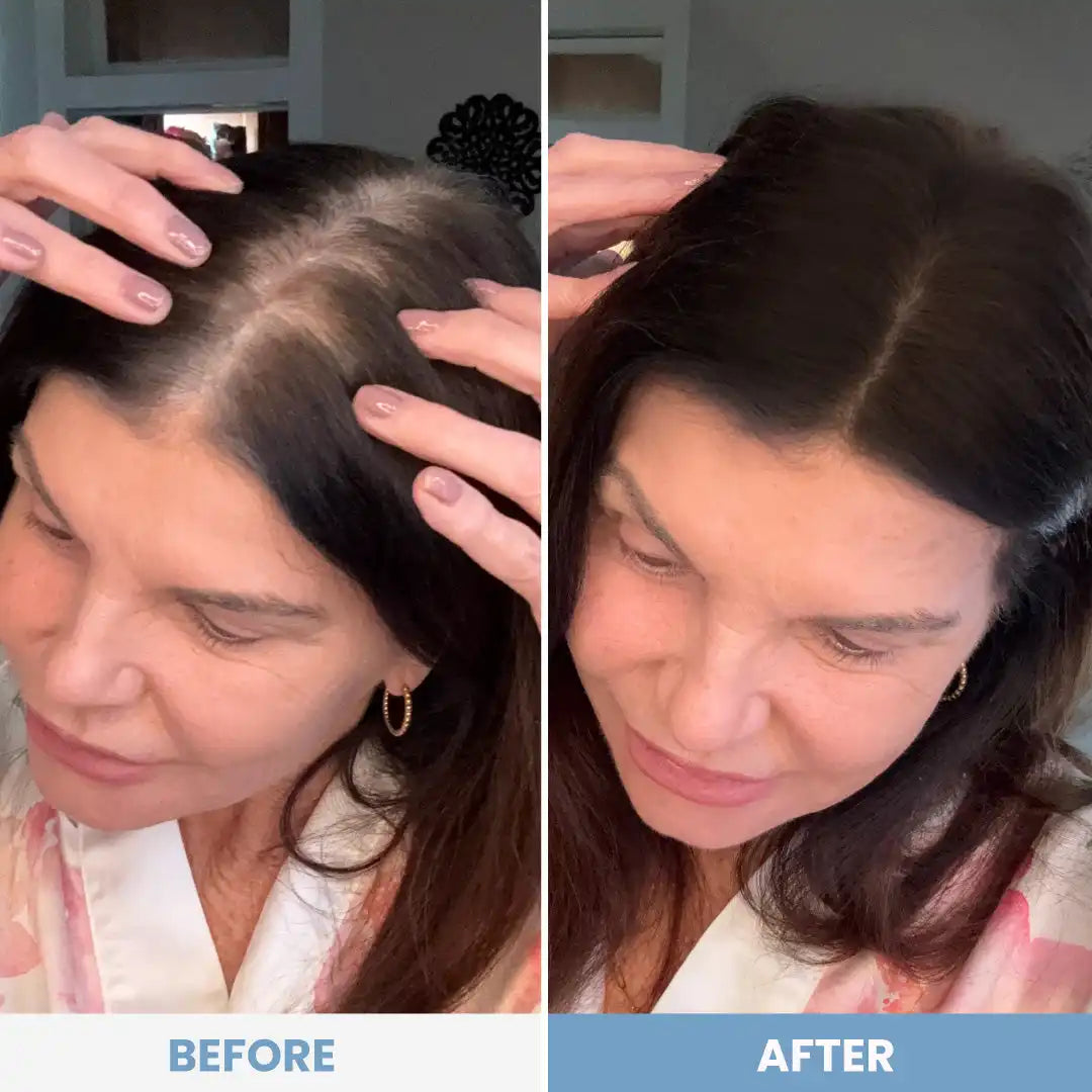 Hairline Perfection Kit