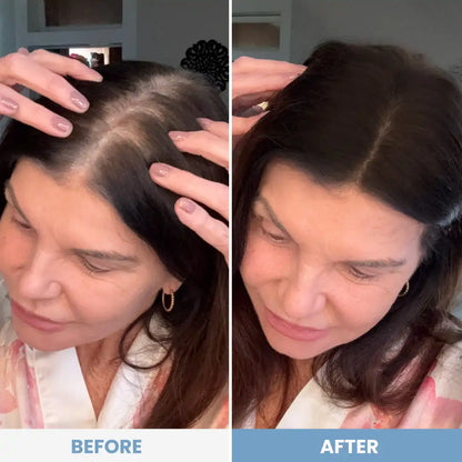 Hairline Perfection Kit