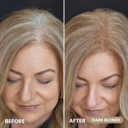 2pcs Instant Coverage Hairline Powder