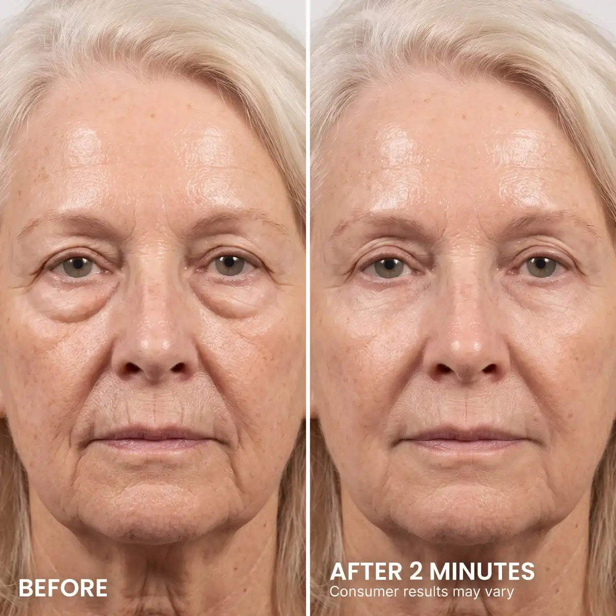 Undereye Rescue Duo